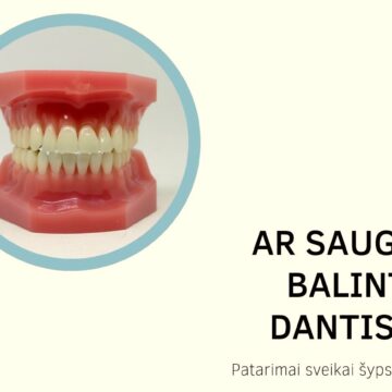 Ar saugu balinti dantis? Patarimai sveikai šypsenai