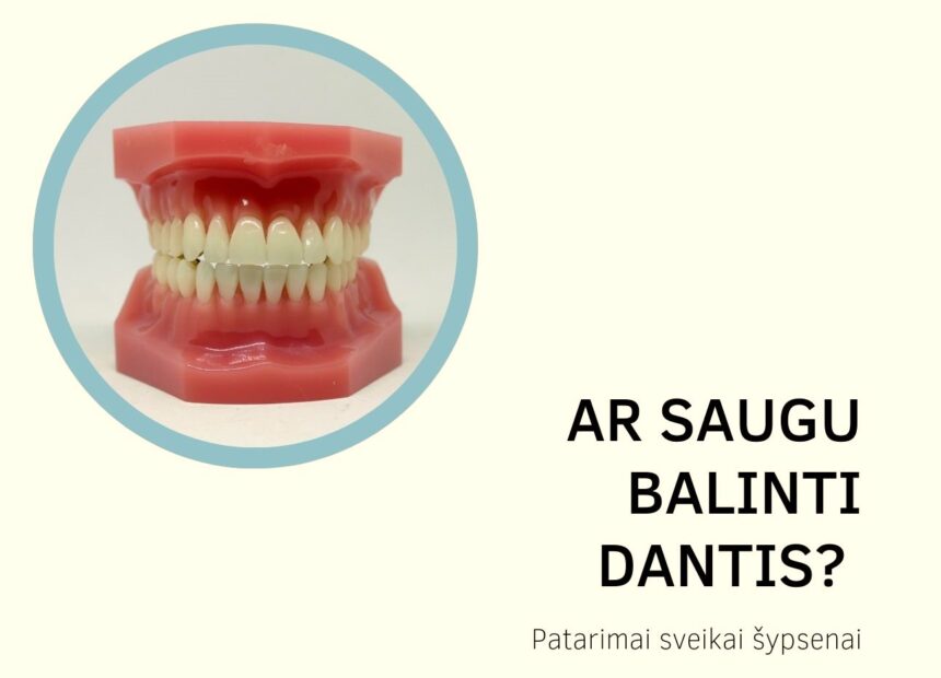 Ar saugu balinti dantis? Patarimai sveikai šypsenai